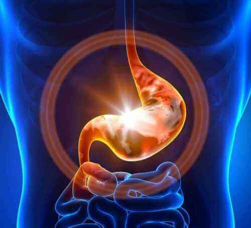 The stomach, ulcers, heartburn, and GERD